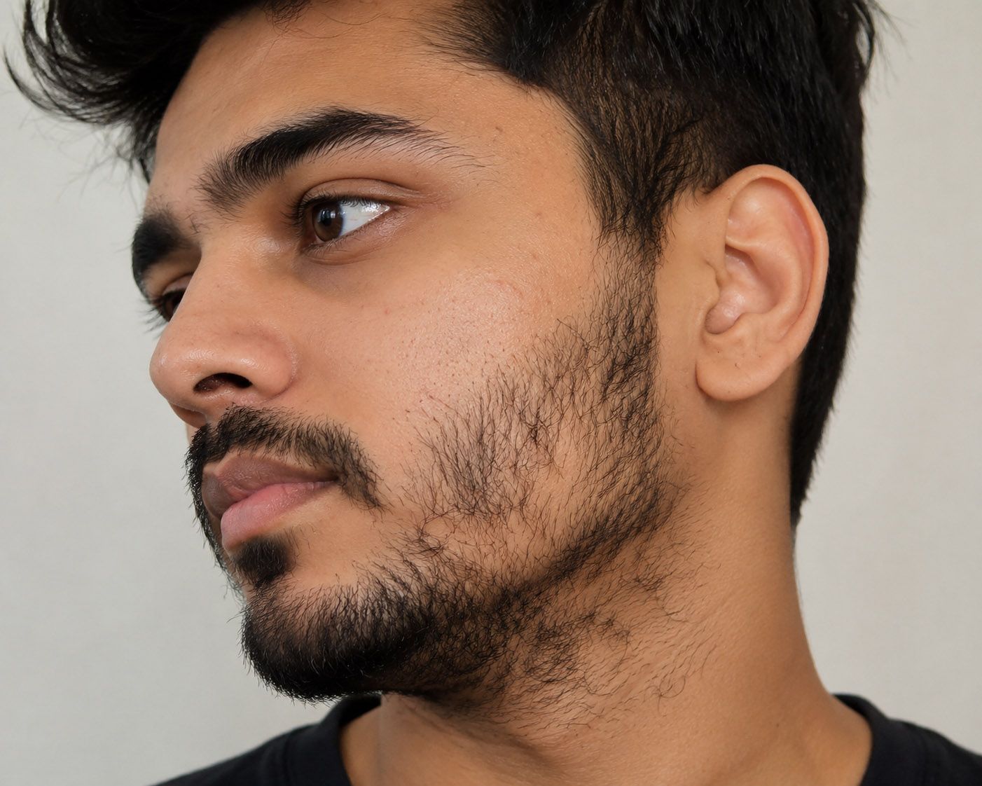 Patchy Beard