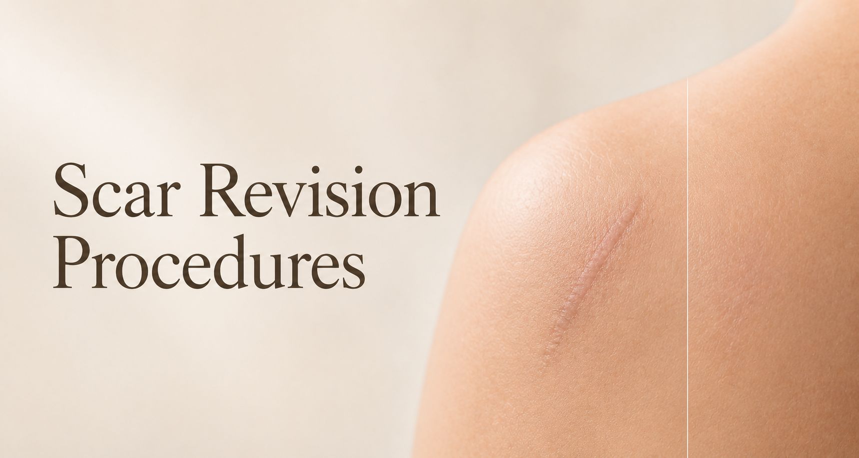 Scar Revision Procedures